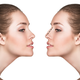 Illustration for article titled Non-surgical Nose Correctionem/em